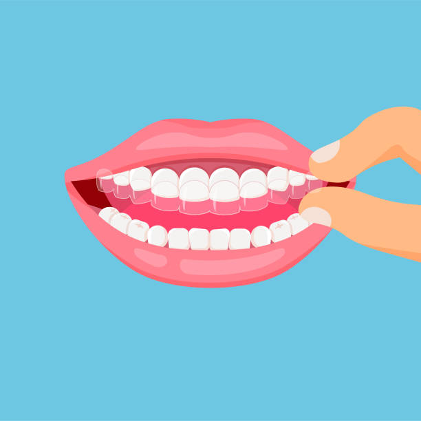 "Why Retainers After Treatment Are So Important"